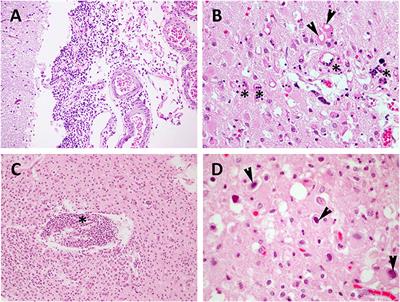 Histopathological Differential Diagnosis of Meningoencephalitis in Cetaceans: Morbillivirus, Herpesvirus, Toxoplasma gondii, Brucella sp., and Nasitrema sp.